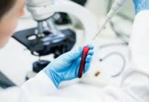 Кровь на краснуху