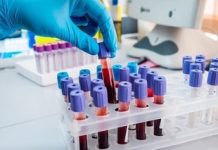 Анализы на аллергены