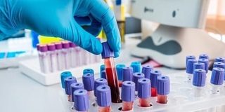 Анализы на аллергены