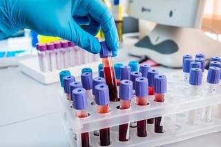 Анализы на аллергены