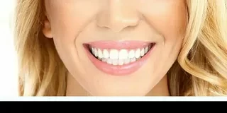 Виниры-показания и противопоказания, способы установки